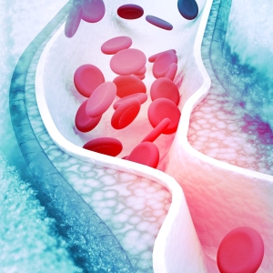 Die ganze Wahrheit über Cholesterin 